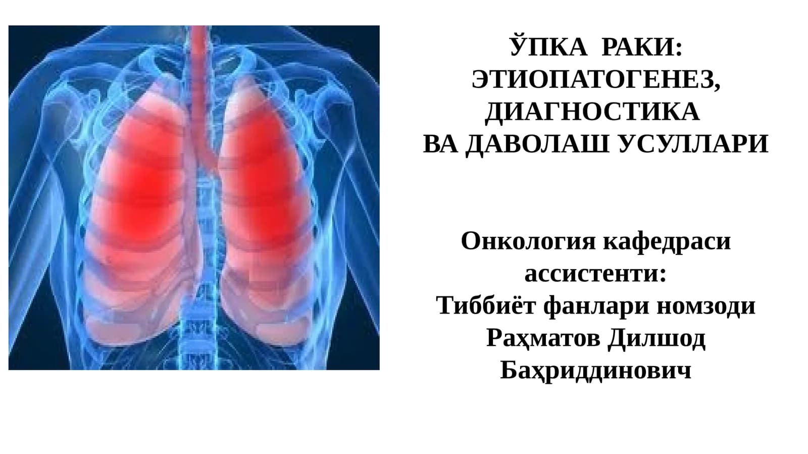 ЎПКА РАКИ: